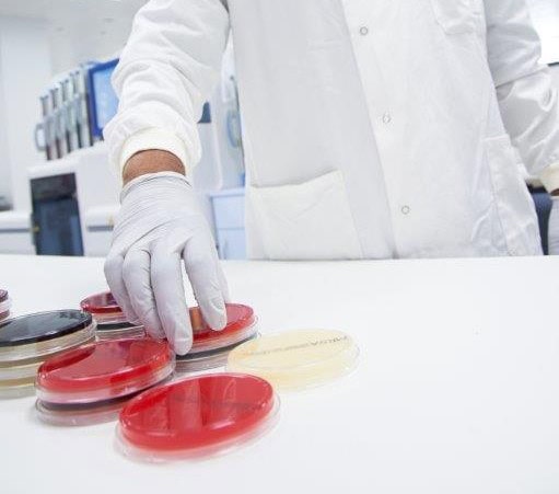 Investigating the incidence, risk factors and source of hospital acquired bacteraemia and candidemia (HABC) in ventilated COVID 19 patients