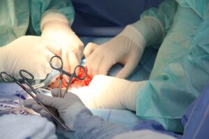 Sepsis Prevention in Surgery: Informing the Clinical Process through Artificial Intelligence