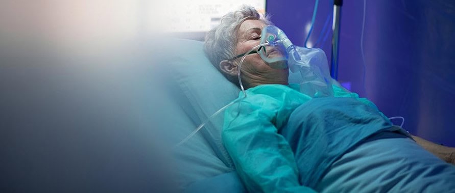 Comparing the burden of hospitalised community acquired pneumonia (CAP) before and during COVID-19 pandemic